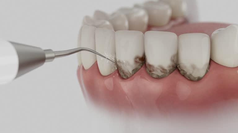 Reliable Tooth Extraction contractor in College, AK by Smile Center Dentistry